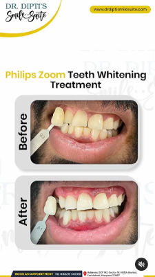 teeth cleaning near me