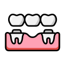 CROWN AND BRIDGES | SERVICES | Dr. Dipti's Smile Suite